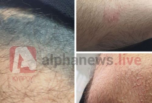 Ιδού τα ντοκουμέντα από τον τραυματισμό ...
